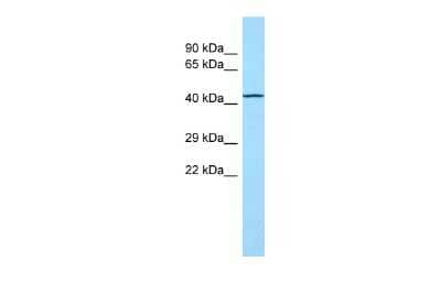 Western Blot: TOR1AIP2 Antibody [NBP2-85971]