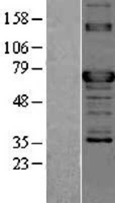 Western Blot: TOR1AIP2 Overexpression Lysate [NBL1-17197]