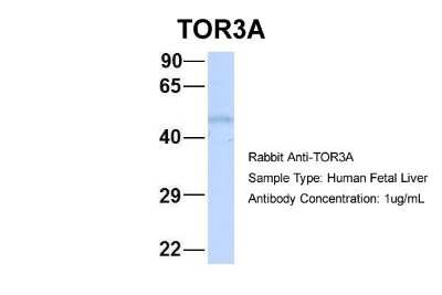 Western Blot: TOR3A Antibody [NBP1-58033]