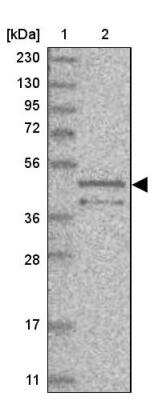 Western Blot: TOR3A Antibody [NBP1-89237]