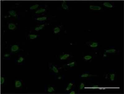 Immunocytochemistry/ Immunofluorescence: TORC1 Antibody (8F9) [H00023373-M01]