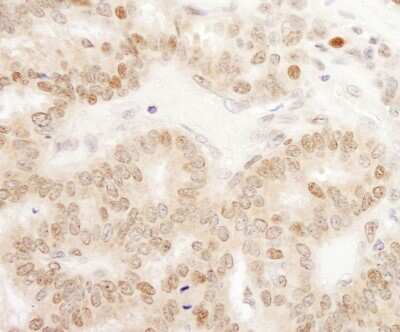 Immunohistochemistry: TORC1 Antibody [NB100-2352]