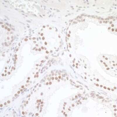 Immunohistochemistry: TORC1 Antibody [NB100-2352]