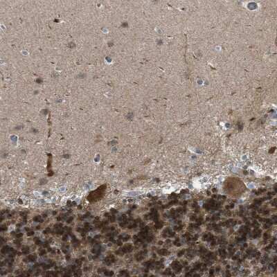 Immunohistochemistry-Paraffin: TORC1 Antibody [NBP1-89865]