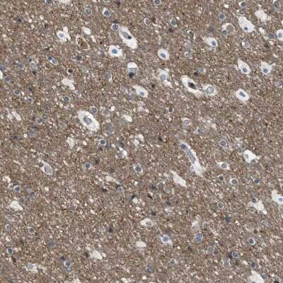 Immunohistochemistry-Paraffin: TORC1 Antibody [NBP1-89865]