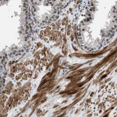 Immunohistochemistry-Paraffin: TORC1 Antibody [NBP1-89865]