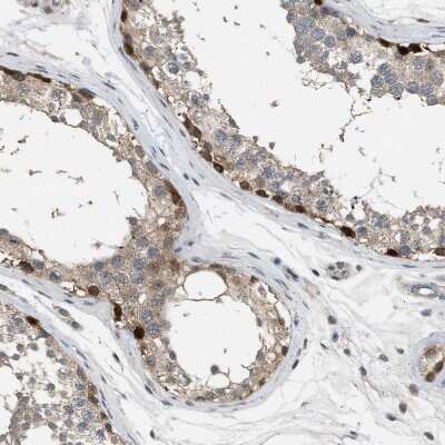 Immunohistochemistry-Paraffin: TORC1 Antibody [NBP1-89865]