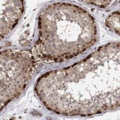 Immunohistochemistry-Paraffin: TORC1 Antibody [NBP3-17667]