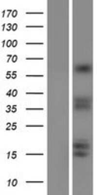 Western Blot: TORC1 Overexpression Lysate [NBP2-07190]