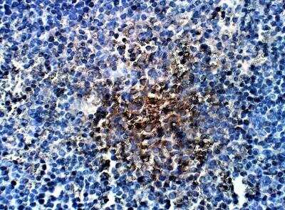 Immunohistochemistry-Paraffin: TORC2 Antibody [NBP3-12359]