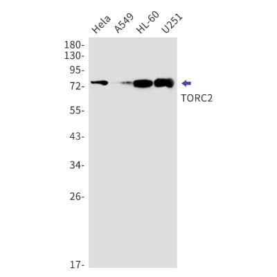 Western Blot: TORC2 Antibody (S05-7H2) [NBP3-20006]