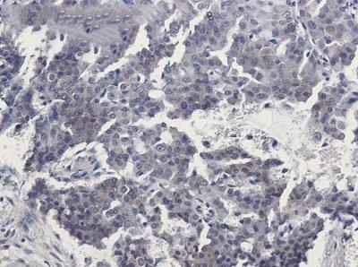 Immunohistochemistry-Paraffin: TORC2 Antibody (S08-5F2) [NBP3-20007]