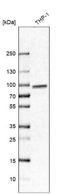 Western Blot: TORC2 Antibody [NBP1-86926]