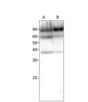 Western Blot: TORC2 Antibody [NBP3-12359]