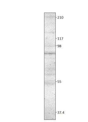 Western Blot: TORC2 Antibody [NBP3-12359]