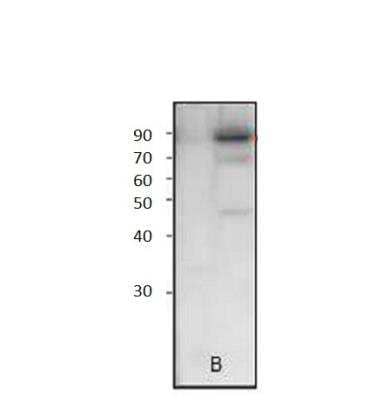 Western Blot: TORC2 Antibody [NBP3-12449]