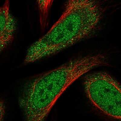 Immunocytochemistry/ Immunofluorescence: TORC3/CRTC3 Antibody [NBP1-83615]