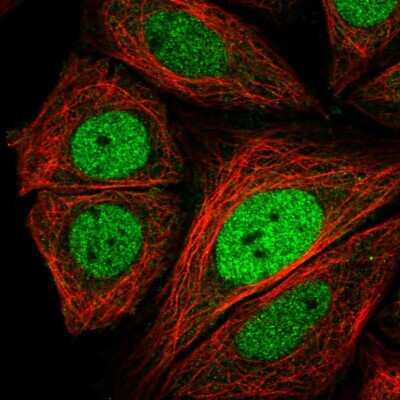 Immunocytochemistry/ Immunofluorescence: TORC3/CRTC3 Antibody [NBP2-56127]