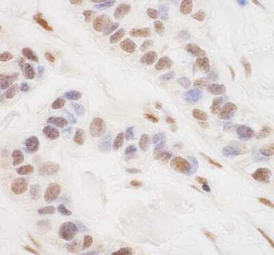 Immunohistochemistry-Paraffin: TORC3/CRTC3 Antibody [NBP1-46832]