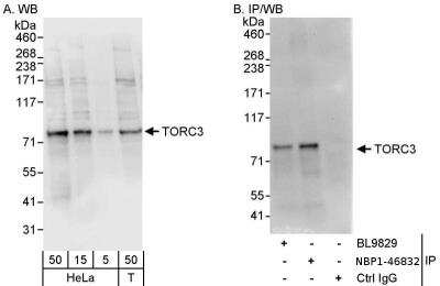 Immunoprecipitation: TORC3/CRTC3 Antibody [NBP1-46832]