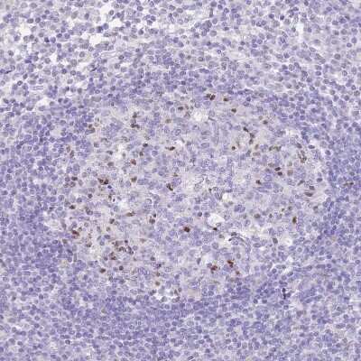 Immunohistochemistry-Paraffin: TOX2 Antibody [NBP2-13464]