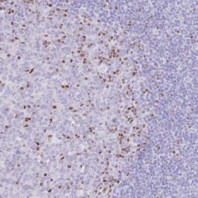 Immunohistochemistry-Paraffin: TOX2 Antibody [NBP2-13464]