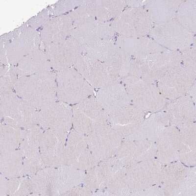 Immunohistochemistry-Paraffin: TOX2 Antibody [NBP2-13464]