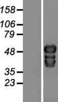 Western Blot: TOX2 Overexpression Lysate [NBL1-17201]