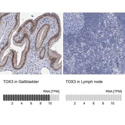 Immunohistochemistry-Paraffin: TOX3 Antibody [NBP1-86676]