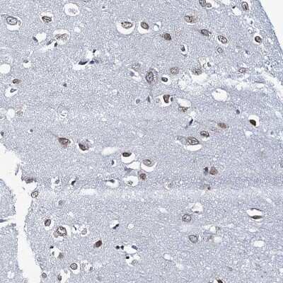 Immunohistochemistry-Paraffin: TOX3 Antibody [NBP1-86676]