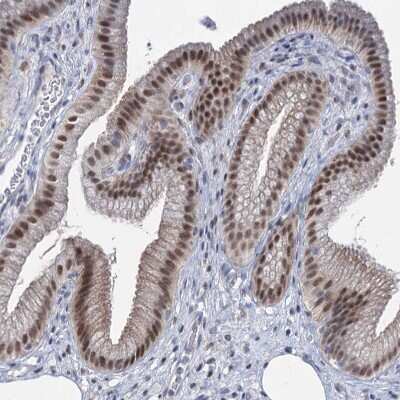 Immunohistochemistry-Paraffin: TOX3 Antibody [NBP1-86676]