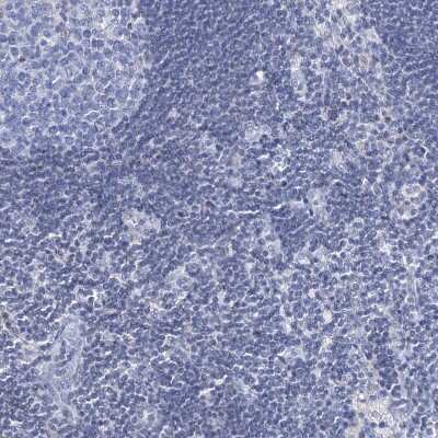 Immunohistochemistry-Paraffin: TOX3 Antibody [NBP1-86676]