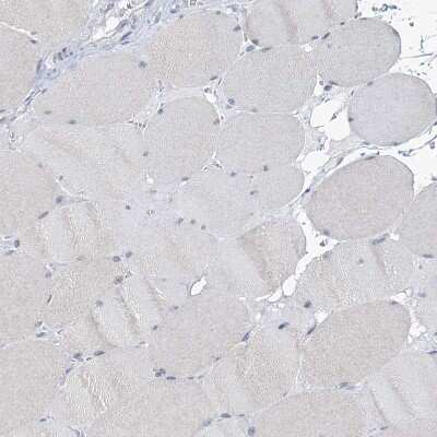 Immunohistochemistry-Paraffin: TOX3 Antibody [NBP1-86676]