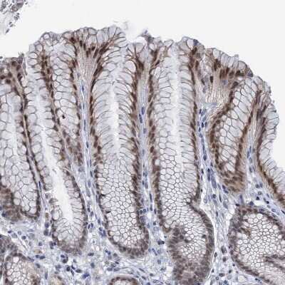 Immunohistochemistry-Paraffin: TOX3 Antibody [NBP1-86676]