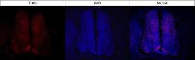 Immunocytochemistry/ Immunofluorescence: TOX3 Antibody (TOX3/1123) - Azide and BSA Free [NBP2-47748]