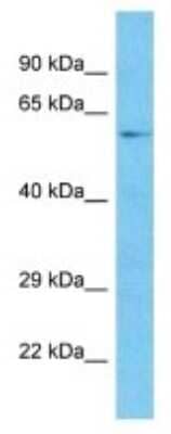 Western Blot: TOX3 Antibody [NBP3-10590]