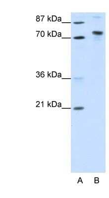 Western Blot: TOX4 Antibody [NBP1-80328]