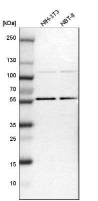 Western Blot: TOX4 Antibody [NBP1-88433]