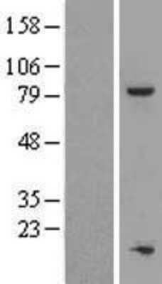 Western Blot: TOX4 Overexpression Lysate [NBL1-17202]