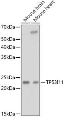 Western Blot: TP53I11 AntibodyAzide and BSA Free [NBP2-93452]