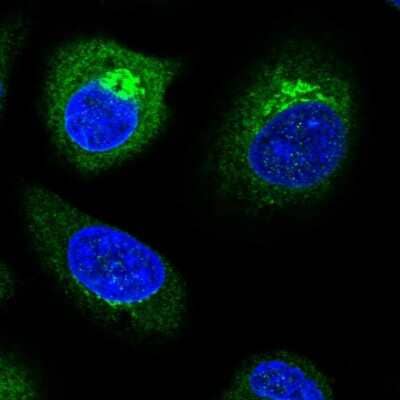 Immunocytochemistry/ Immunofluorescence: TP53I11 Antibody [NBP2-32593]