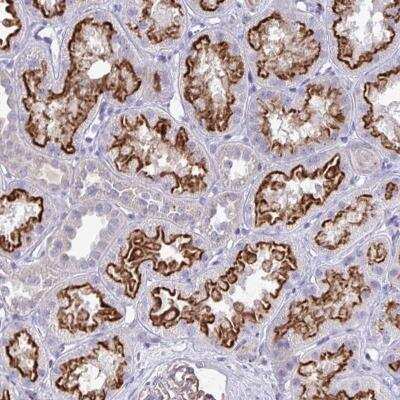 Immunohistochemistry-Paraffin: TP53I11 Antibody [NBP2-32491]