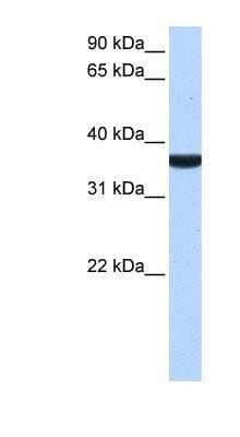 Western Blot: TP53I13 Antibody [NBP1-79465]