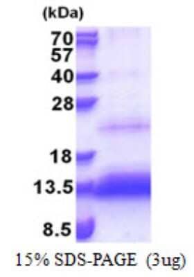 SDS-PAGE: Recombinant Human HSPC132 His Protein [NBP2-22873]