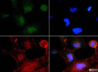 Immunocytochemistry/ Immunofluorescence: TP53INP2 Antibody - BSA Free [NBP1-71704]