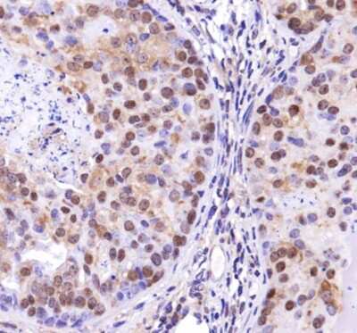 Immunohistochemistry: TP53INP2 Antibody - BSA Free [NBP1-71704]