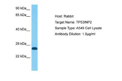 Western Blot: TP53INP2 Antibody [NBP2-84309]