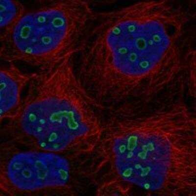 Immunocytochemistry/ Immunofluorescence: TP53TG5 Antibody [NBP3-17044]