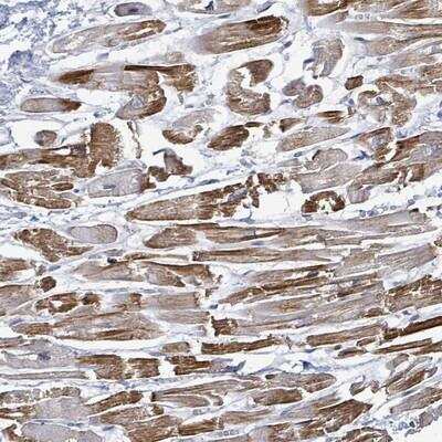 Immunohistochemistry: TP53TG5 Antibody [NBP2-13467]