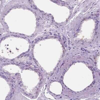 Immunohistochemistry-Paraffin: TP53TG5 Antibody [NBP2-13467]